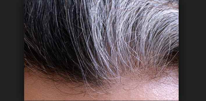 Benefits of Tea for Hair