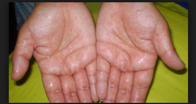 Ciri Penyakit Jantung dan cara mengatasinya